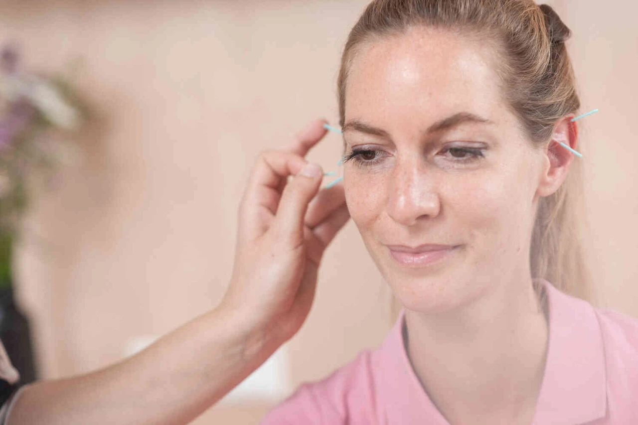 Frau bekommt Akupunkturnadeln im Ohr gesetzt